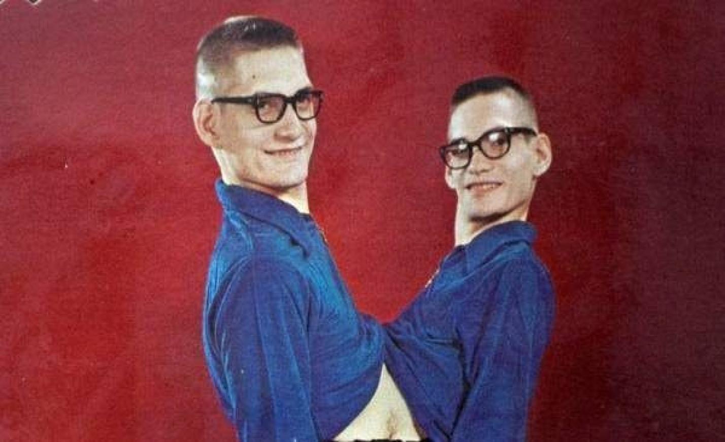 Elhunyt Ronnie és Donnie, a leghosszabb életű sziámi ikerpár